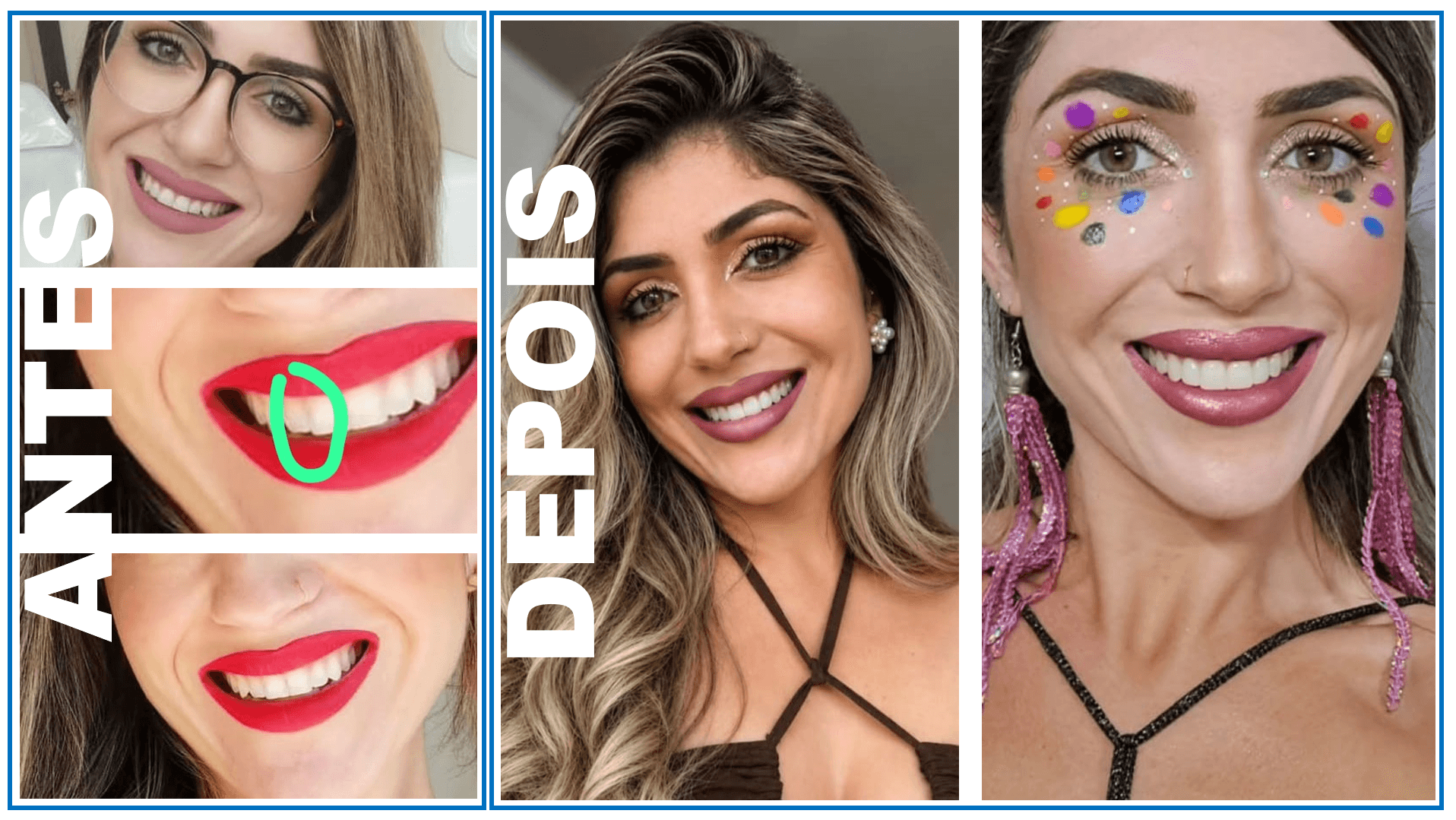 Antes e Depois Ariane TXT.png