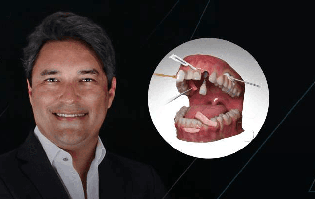 Univali Be Dental School recebe imersão inédita em Periodontia com foco em regeneração gengival